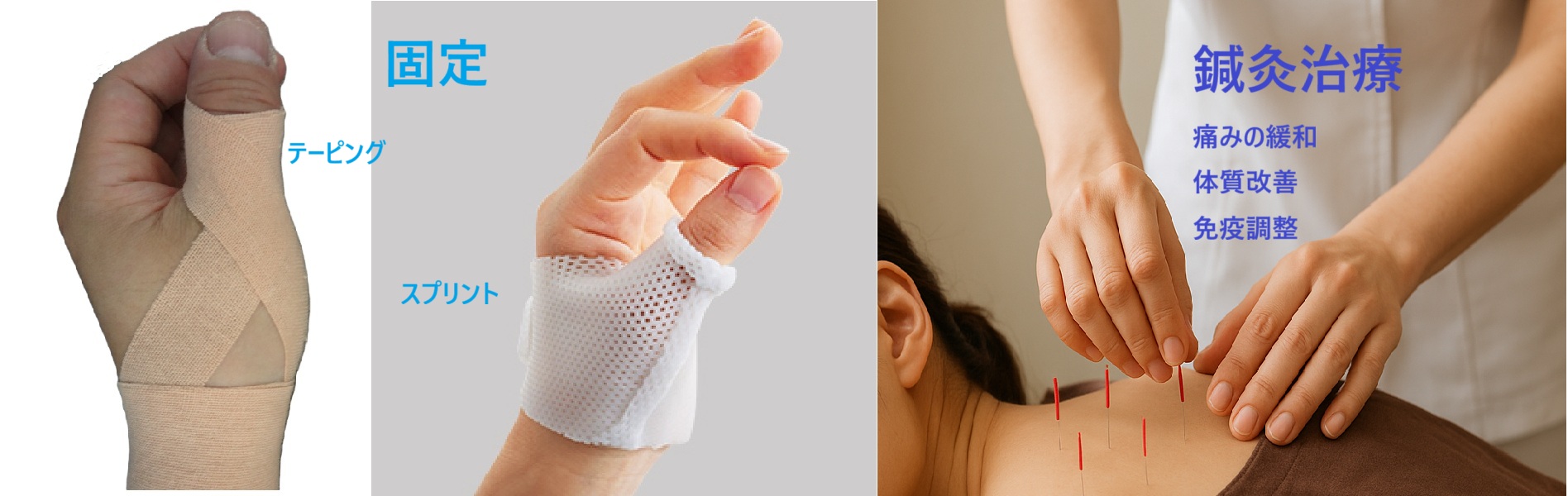 温熱療法を受ける女性